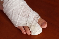 Broken Toe Causes and Treatment