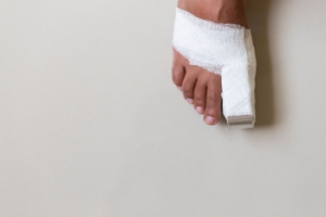 Broken Toe Care