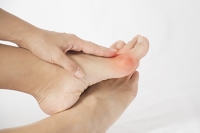 Bunions and Heredity