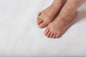 Implant Options for Rigid Hammertoe